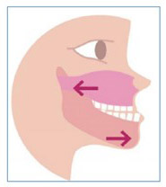 Incisives-2-2